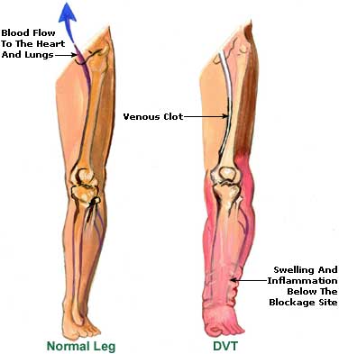Muscle Leg