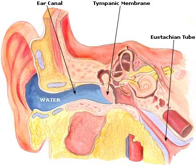 Ear Canal Swelling